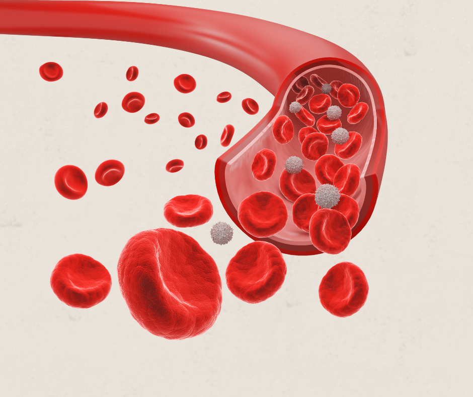 Vein with dissection to show blood vessels 